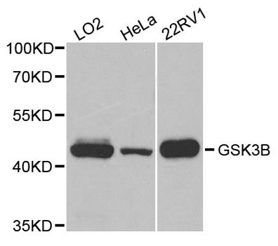 Western blot - GSK3B Polyclonal Antibody (144-06164)