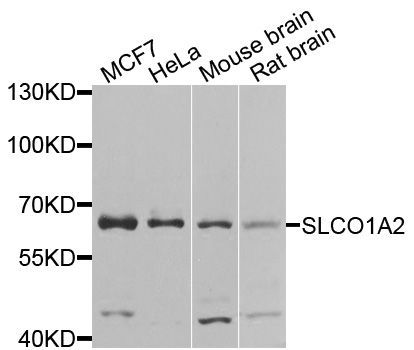 Western blot - SLCO1A2 antibody (144-08452)