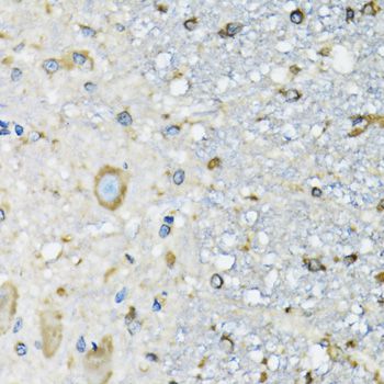 Immunohistochemistry - DARS Polyclonal Antibody (144-06574)