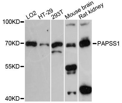 Western blot - PAPSS1 antibody (144-013773)