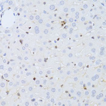 Immunohistochemistry - ZEB2 Polyclonal Antibody (144-05705)