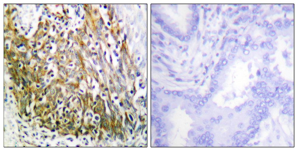 IHC