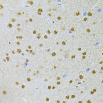 Immunohistochemistry - ANP32A Antibody (144-05768)