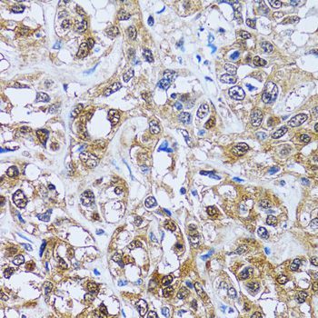 Immunohistochemistry - IMPA1 antibody (144-06381)