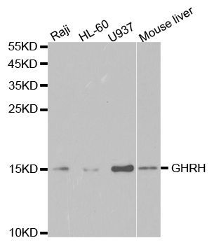 Western blot - GHRH antibody (144-05343)