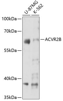 Western blot