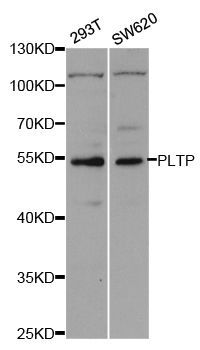Western blot - PLTP antibody (144-05628)