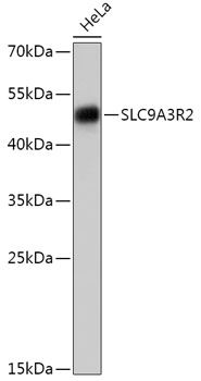 Western blot