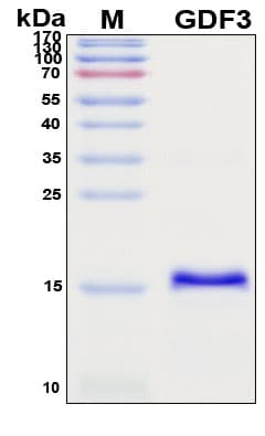 SDS-PAGE Image