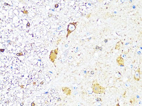 Immunohistochemistry - TH Polyclonal Antibody (144-00028)