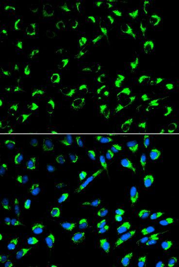 Immunofluorescence - SFN Polyclonal Antibody (144-01026)