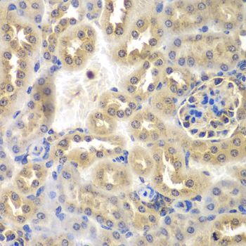 Immunohistochemistry - SULT2B1 antibody (144-07736)