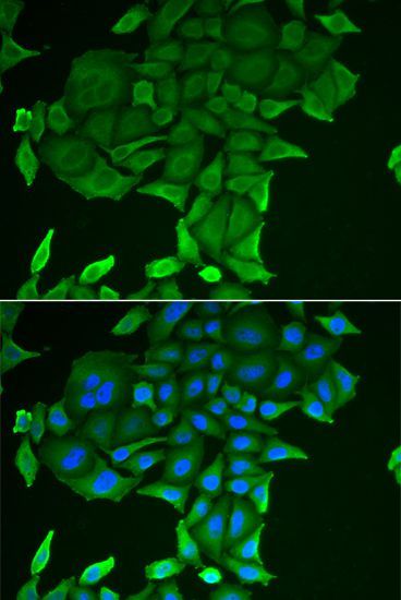 Immunofluorescence - CD84 antibody (144-06433)