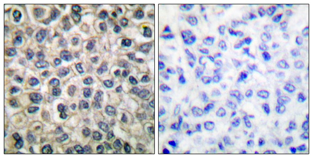 IHC