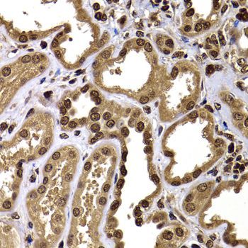 Immunohistochemistry - GPS1 Polyclonal Antibody (144-06917)