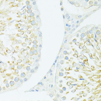 Immunohistochemistry - MYH10 antibody (144-012029)