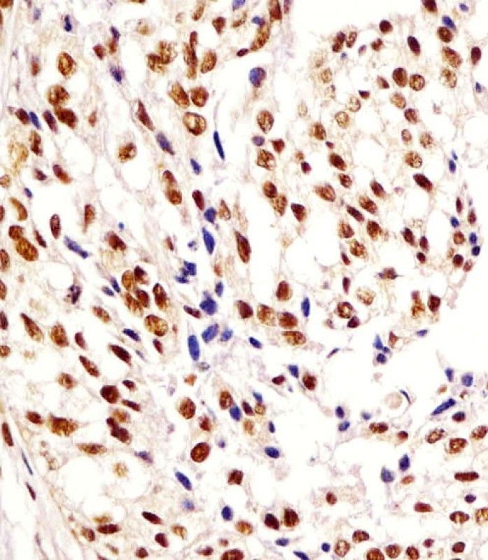 IHC-P