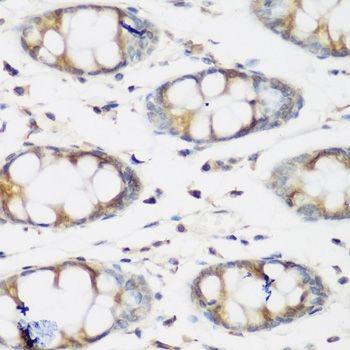 Immunohistochemistry - BMP2 Polyclonal Antibody (144-00231)