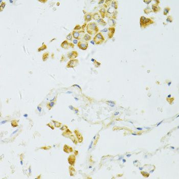 Immunohistochemistry - SIRT2 antibody (144-12575)
