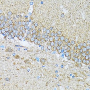 Immunohistochemistry - Caspase3 Polyclonal Antibody (144-60067)