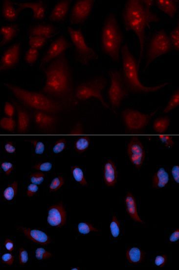 Immunofluorescence - PLCB1 antibody (144-01971)