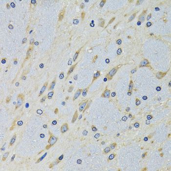 Immunohistochemistry - DARS Polyclonal Antibody (144-06574)