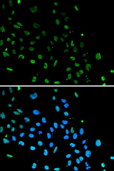 Immunofluorescence - XRCC5 antibody (144-05862)
