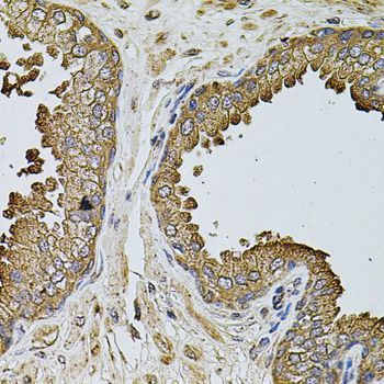Immunohistochemistry - MTIF3 antibody (144-08524)