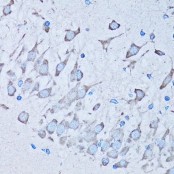Immunohistochemistry - NNMT antibody (144-06673)