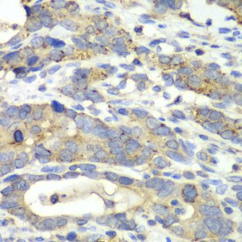 Immunohistochemistry - CHMP2B antibody (144-013410)