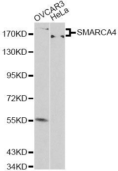 Western blot - [KO Validated] SMARCA4 Polyclonal Antibody (144-00887)