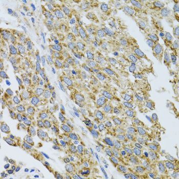 Immunohistochemistry - CYP1A1 antibody (144-02159)