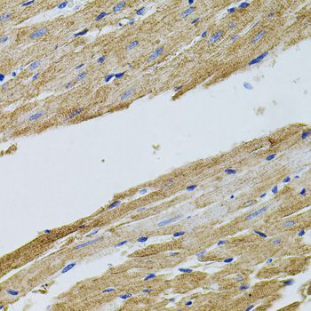 Immunohistochemistry - TRMT2A antibody (144-05975)