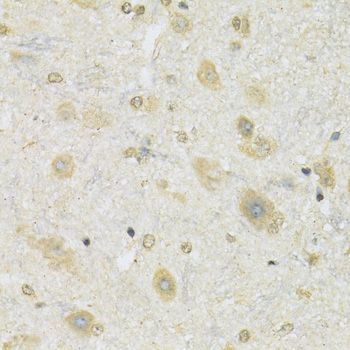Immunohistochemistry - SLC2A13 Polyclonal Antibody (144-09993)