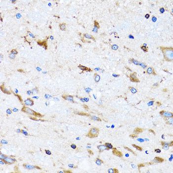 Immunohistochemistry - PTRH2 antibody (144-06466)