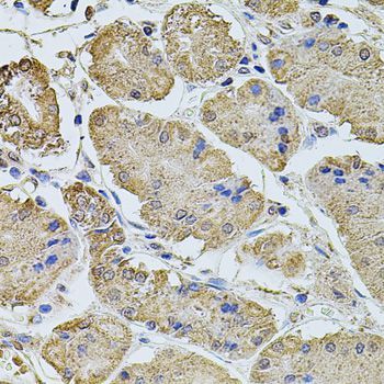 Immunohistochemistry - PTCD3 Polyclonal Antibody (144-08497)