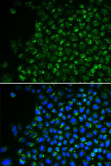 Immunofluorescence - PDHA1 antibody (144-01895)