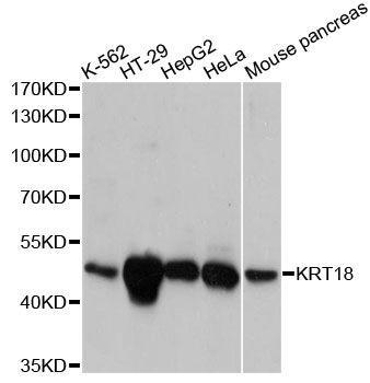Western blot - KRT18 Polyclonal Antibody (144-60052)