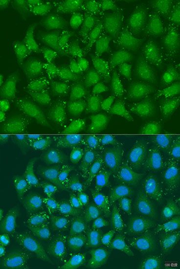 Immunofluorescence - XBP1 antibody (144-01731)