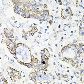 Immunohistochemistry - ACVR2A Polyclonal Antibody (144-01981)