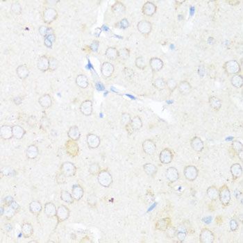 Immunohistochemistry - EIF3J Polyclonal Antibody (144-08637)