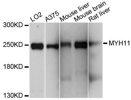 Western blot - MYH11 Polyclonal Antibody (144-10827)