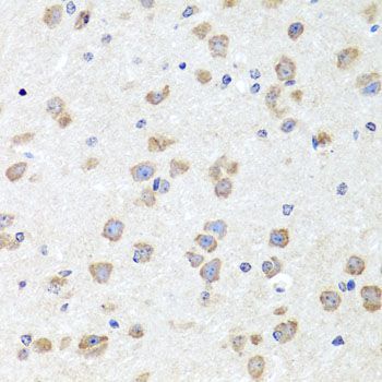 Western blot - [KO Validated] CHD1 Polyclonal Antibody (144-07883)