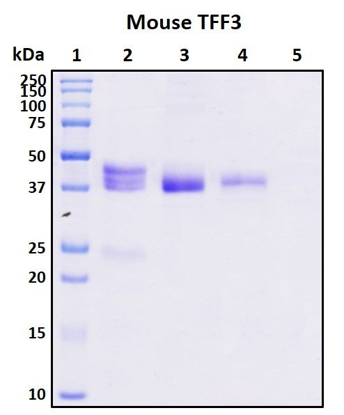 SDS-PAGE