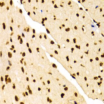 Immunohistochemistry - DiMethyl-Histone H3-K27 pAb (144-02362)