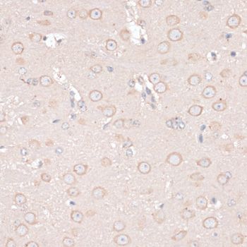 Immunohistochemistry - ABCF2 antibody (144-012555)