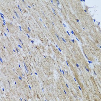 Immunohistochemistry - HYAL1 antibody (144-06623)