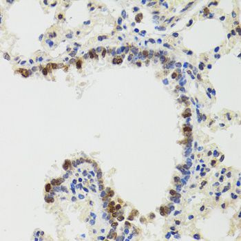 Immunohistochemistry - IKBKG Polyclonal Antibody (144-00917)