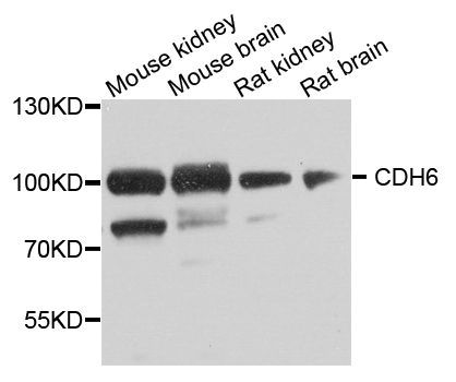 Western blot - CDH6 antibody (144-08109)