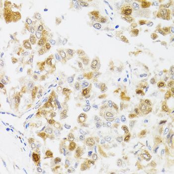 Immunohistochemistry - MYO5A antibody (144-09830)
